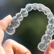 palatal expander Kieferorthopädie Elbvororte Dr. Stephanie Wodianka